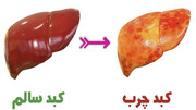 بهترین و ساده‌ترین دستورالعمل‌های طب سنتی برای پیشگیری و درمان "کبد چرب"