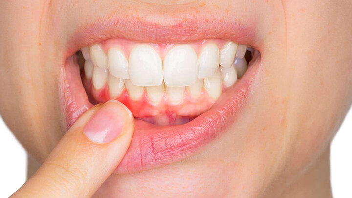 رشد دوباره دندان‌ های آسیب دیده ممکن شد