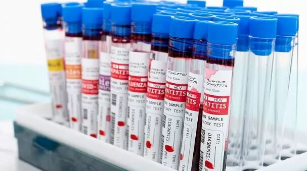 غرامت لندن به دریافتکنندگان خونهای آلوده غرامت لندن به دریافتکنندگان خونهای آلوده